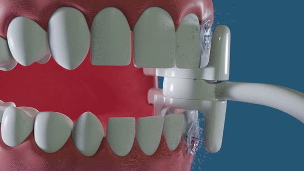 Miracle Magic Flosser