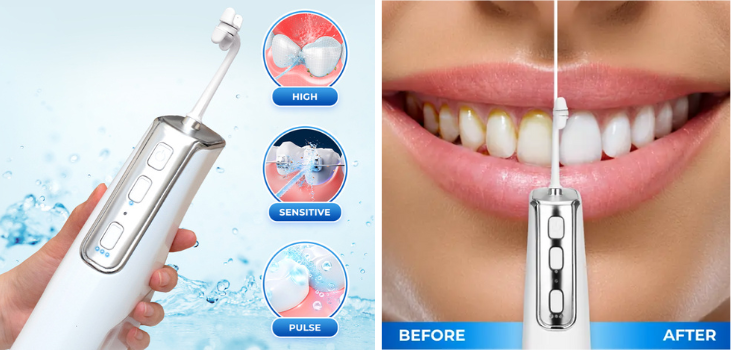 Miracle Magic Flosser